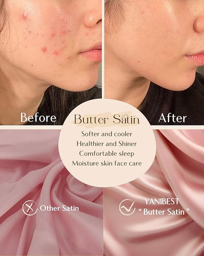 Yanibest Satin Pillowcase, King Size Pillow Cases Set of 2 - Silk Pillow Cases for Hair and Skin with Zipper, Silk Pillow Cases King for 20"x40", Exquisite Packaging for Women Men
