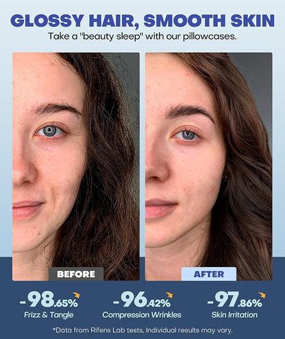 Ice Cooling Pillowcase for Hot Sleepers, Instantly Cool, Stays Cold All Night, Softer Than Silk Pillow Cases, Pillow Covers with Invisible Zipper, Gift for Men & Women - King Size, Light Gray (1 Pack)